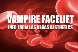 Read more about the article What is a Vampire FaceLift treatment anyway?