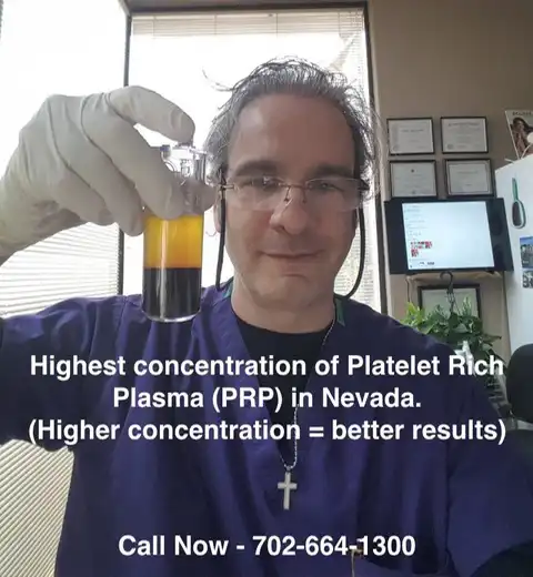 Thomas Pulice PA-C holding PRP concentrate prepared for Vampire Facelift treatment — Las Vegas Aesthetics